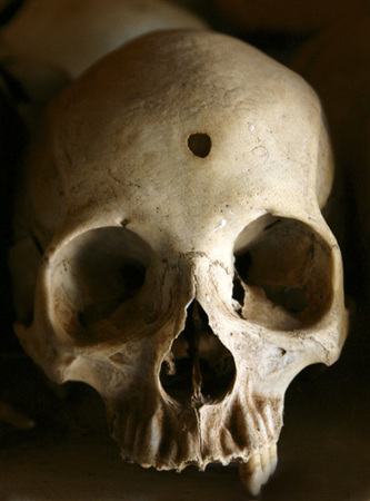 A victim of the 1994 Rwandan genocide.